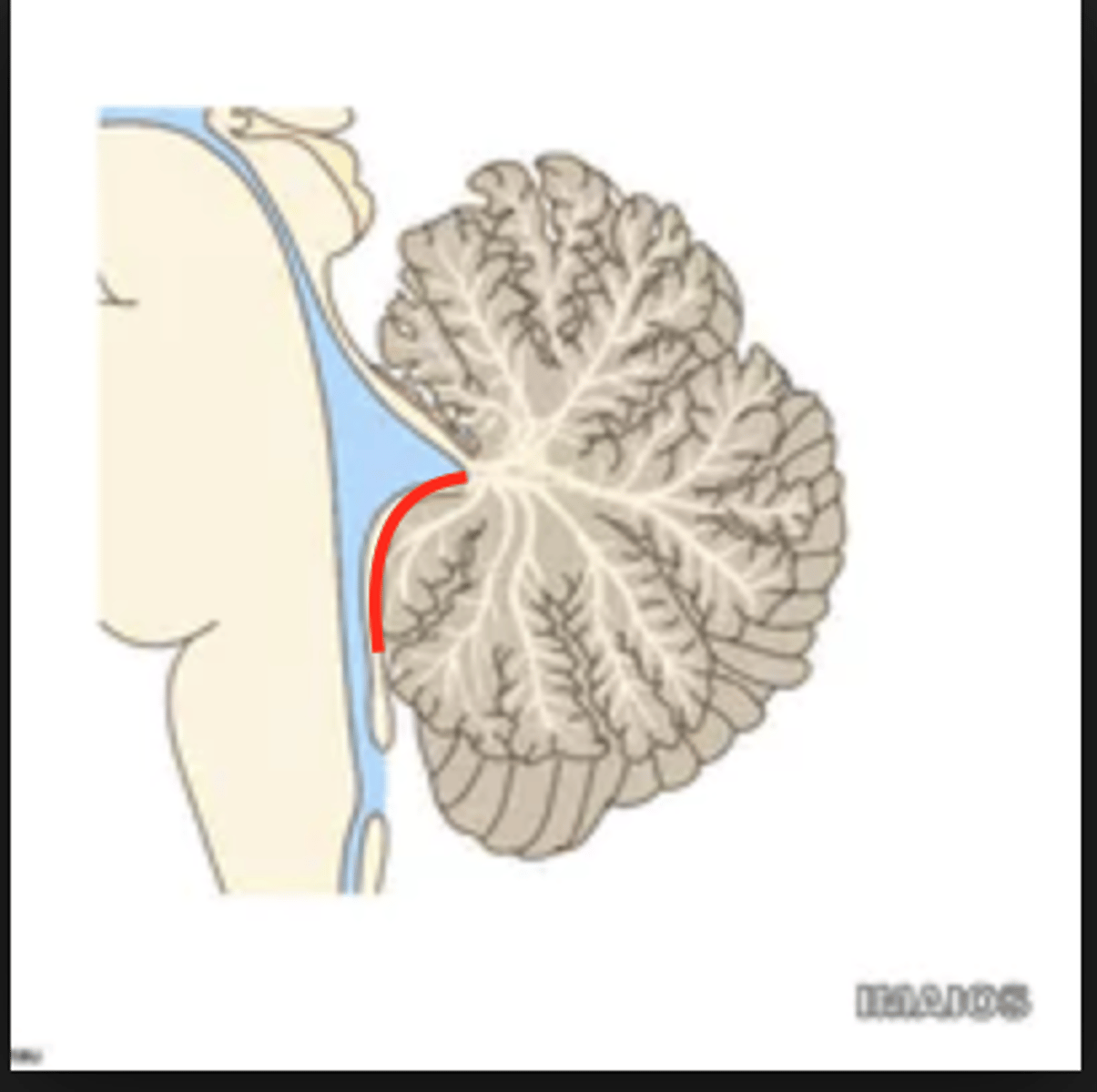 <p>inferior medullary velum</p>
