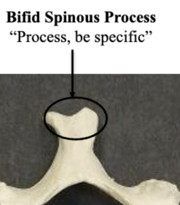 <p>Bifid Spinous Process</p>