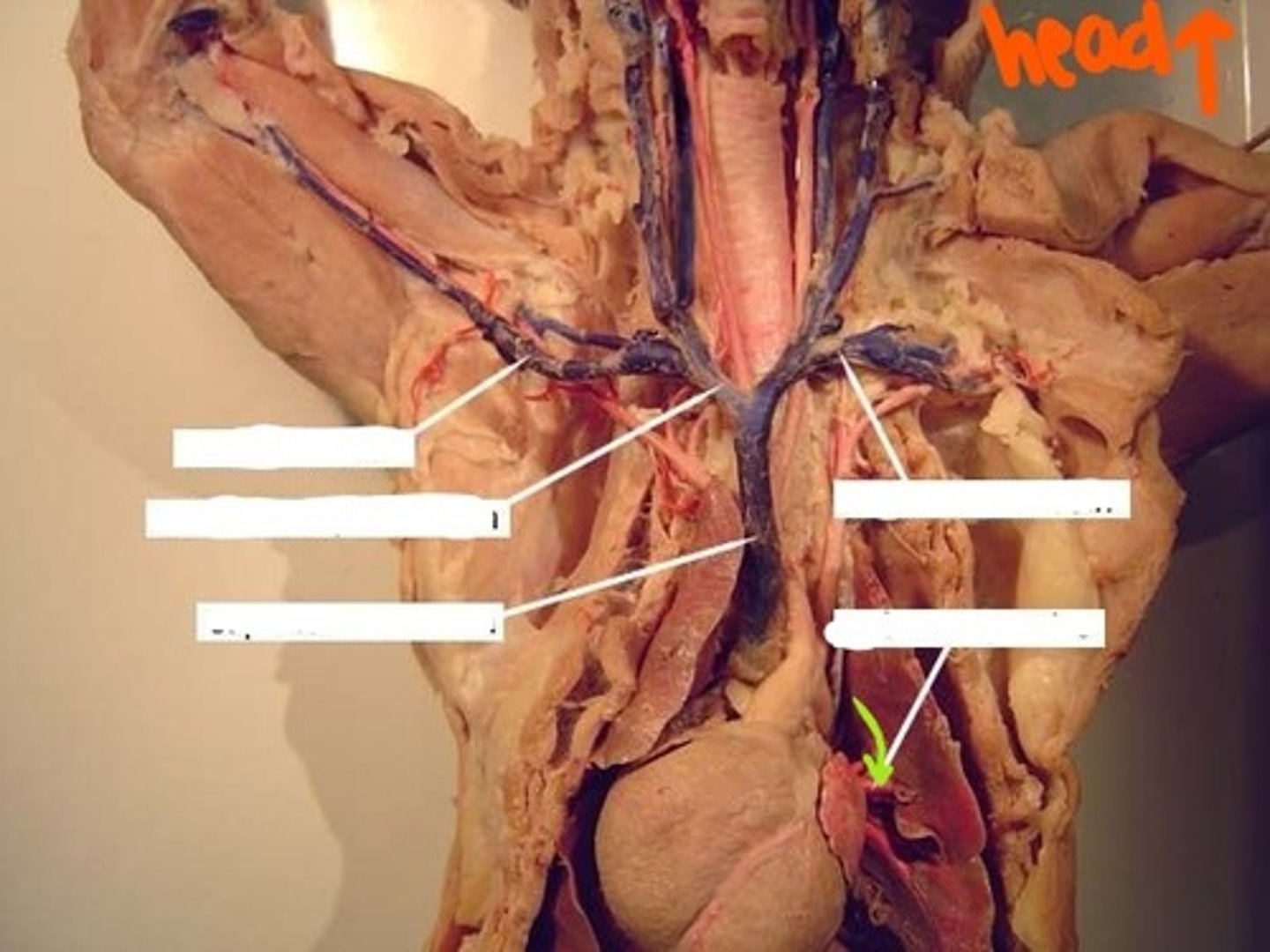 <p>identify this vein</p>