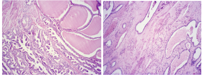 <p>this is?&nbsp;</p>