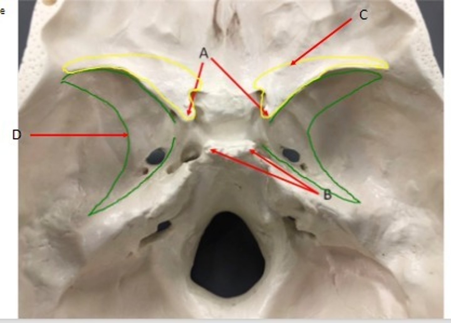 <p>What category of bone is it? What bone is it? Label the structures.</p>