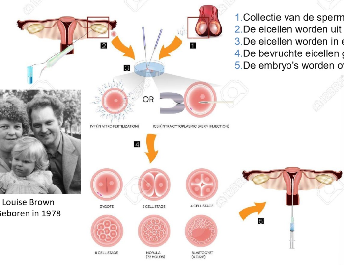 <ol><li><p>collectie van de sperma cellen</p></li><li><p>eicellen worden uit de eierstok verwijderd</p></li><li><p>eicellen worden in een laboratorium bevrucht met sperma</p></li><li><p>bevruchte eicellen groeien</p></li><li><p>embryo’s worden overgebracht naar de baarmoeder</p></li></ol><p>→ hormonale inductie van een ‘super-ovulatie’: meerdere rijpe follikels</p><ul><li><p>fusie van gameten in vitro</p></li></ul><p>(ICSI: injectiebevruchting, IntaCytoplasmic Sperm Injection)</p><p></p>
