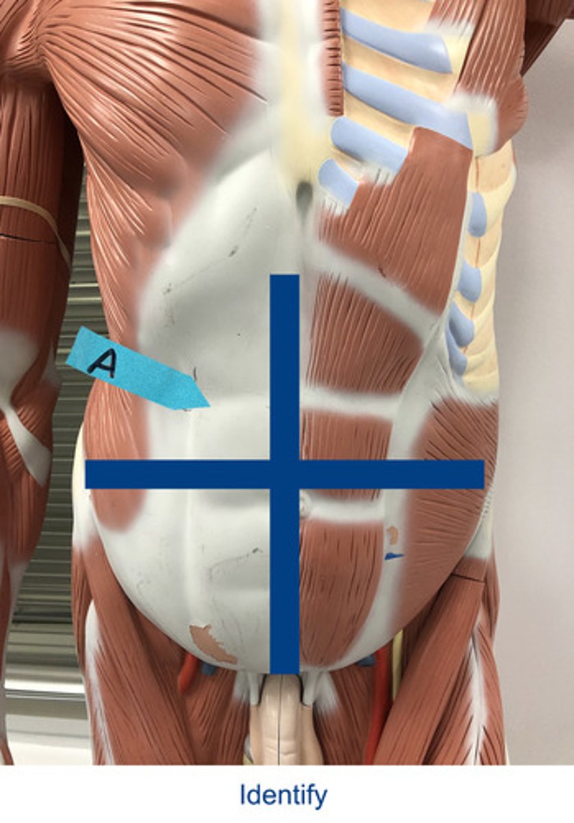 <p>Identify the area indicated by the arrow.</p>