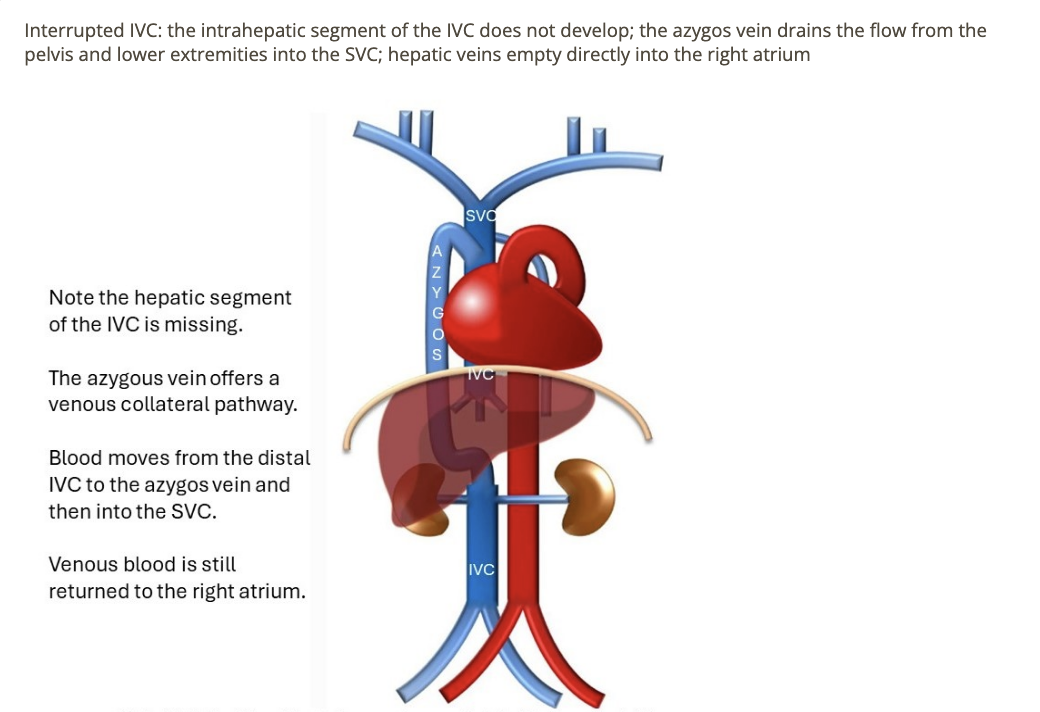 <p>b) azygous vein = collateral + empties into SVC</p>