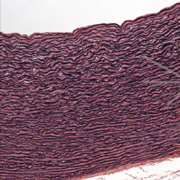 <p>function- recoil after stretching, maintains flow of blood through arteries</p><p>location- walls of large arteries, in ligaments in vertebral column, walls of bronchial tubes&nbsp;</p>