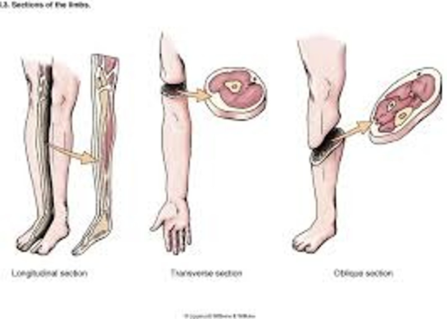 <p>longitudinal, transverse, oblique</p>