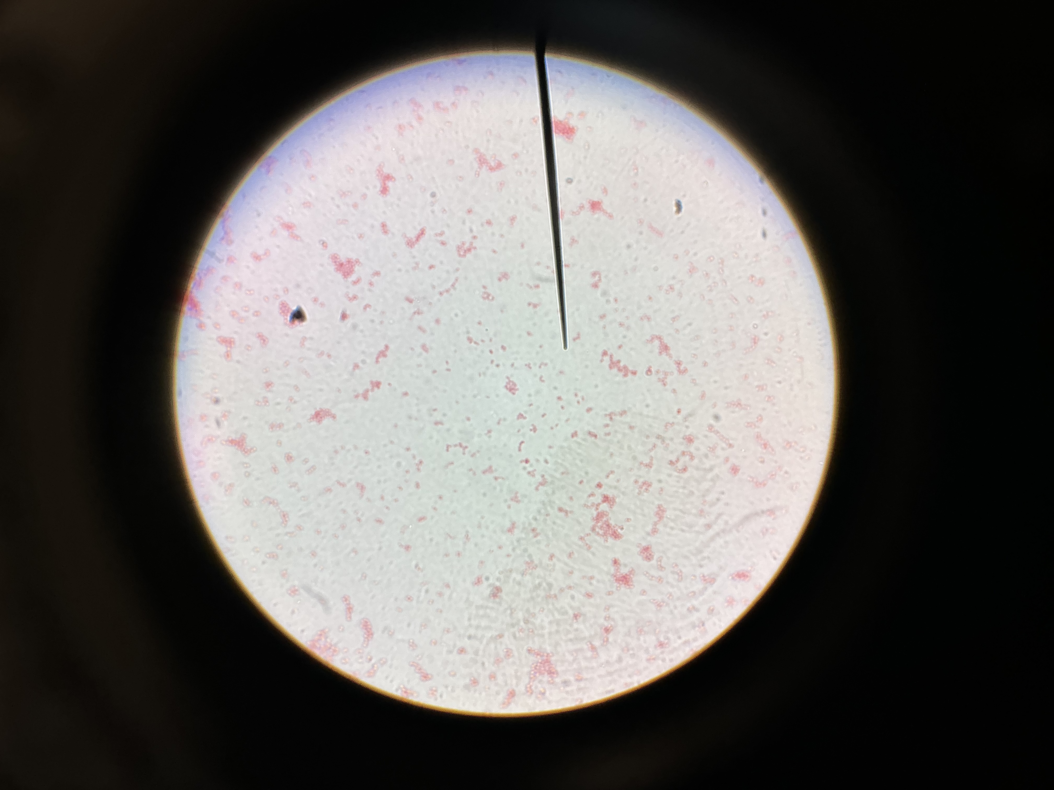 <p>N. gonorrhoea</p>