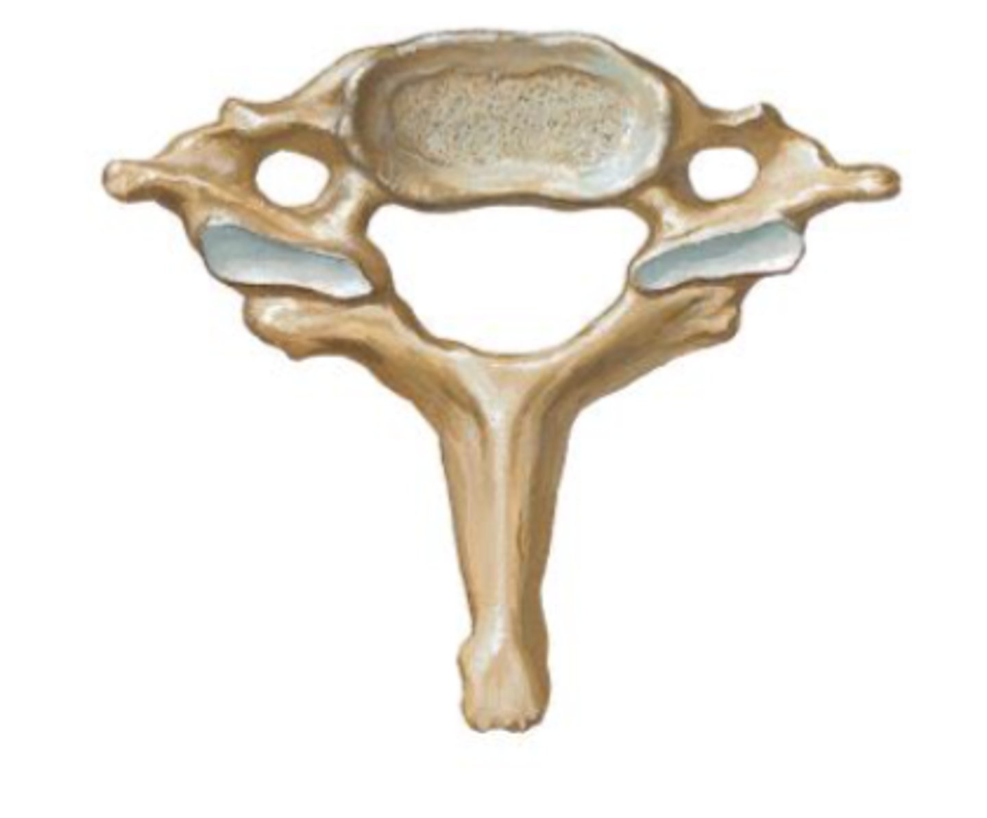 <p>What type of vertebrae is picture here?</p>
