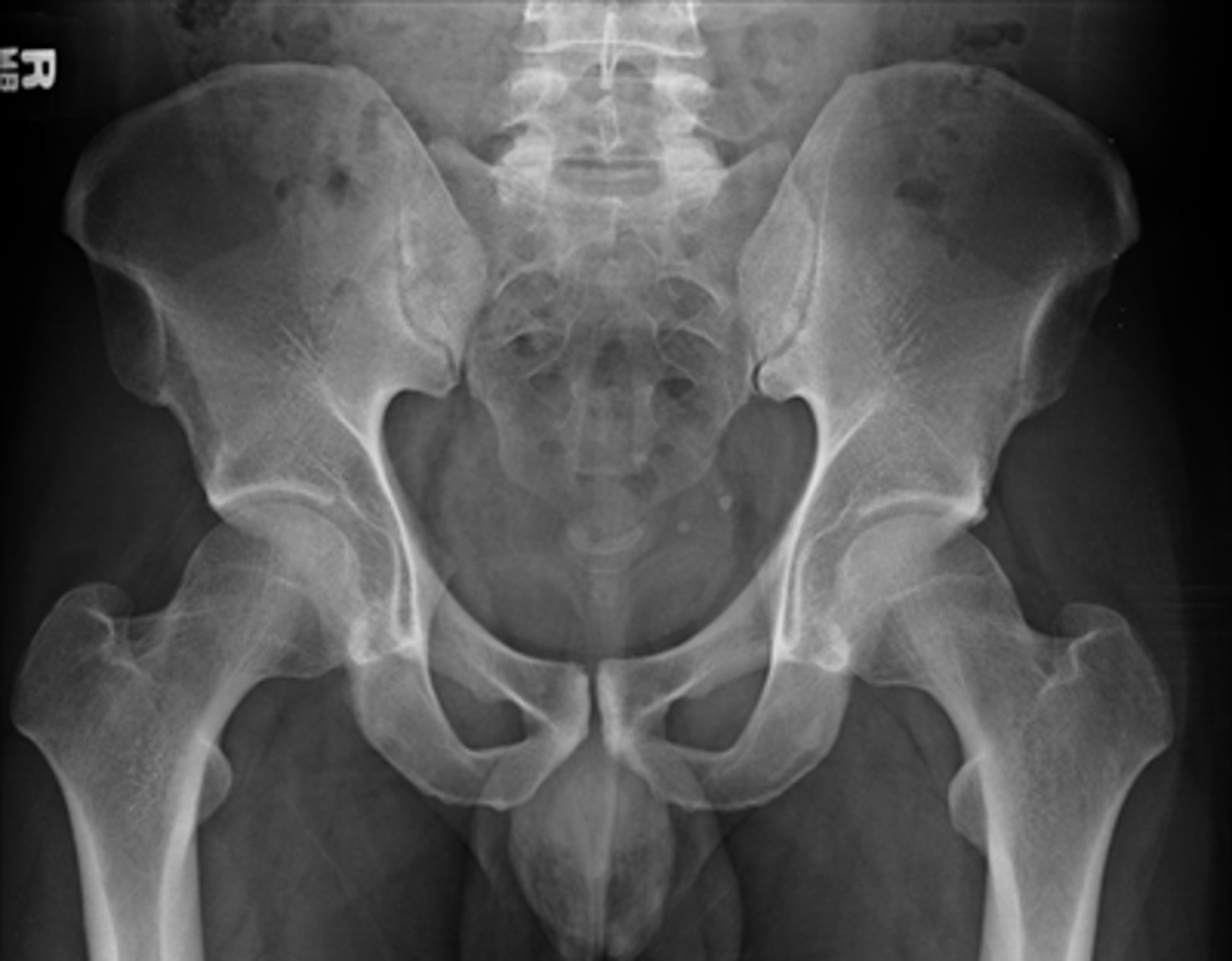 <p>What sex is this patient? How do you know?</p>