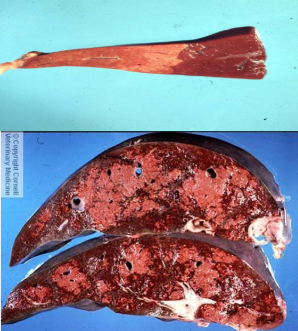 <p>What are these liver changes? State the distributions</p>