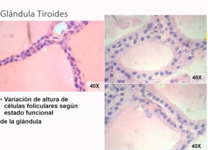 <p>Foliculos tiroideos: Activos e inactivos</p>