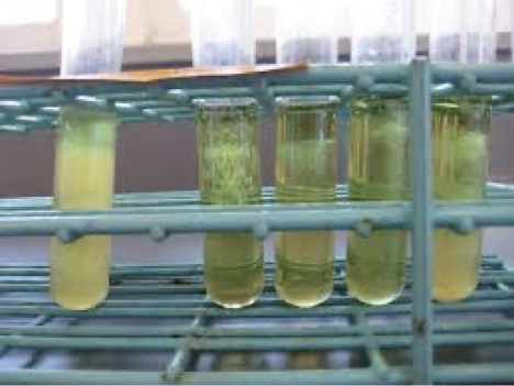 <p><span><span>Enriched broth mediumCan identify bacteria by where they grow in the broth</span></span></p><p><span style="font-family: "Wingdings 2";"><span></span></span><span><span>Strict aerobes grow only at the top</span></span></p><p><span style="font-family: "Wingdings 2";"><span></span></span><span><span>Facultative organisms grow throughout</span></span></p><p><span style="font-family: "Wingdings 2";"><span></span></span><span><span>Anaerobes grow at the bottom</span></span></p><p><span style="font-family: "Wingdings 2";"><span></span></span><span><span>Microaerophiles grow in the middle</span></span></p>