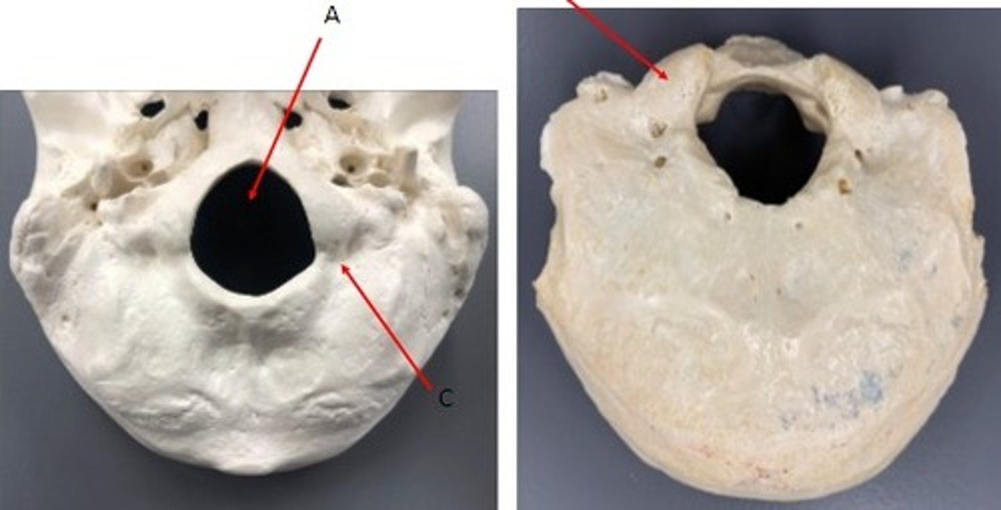<p>What category of bone is it? What bone is it? Label the structures.</p>