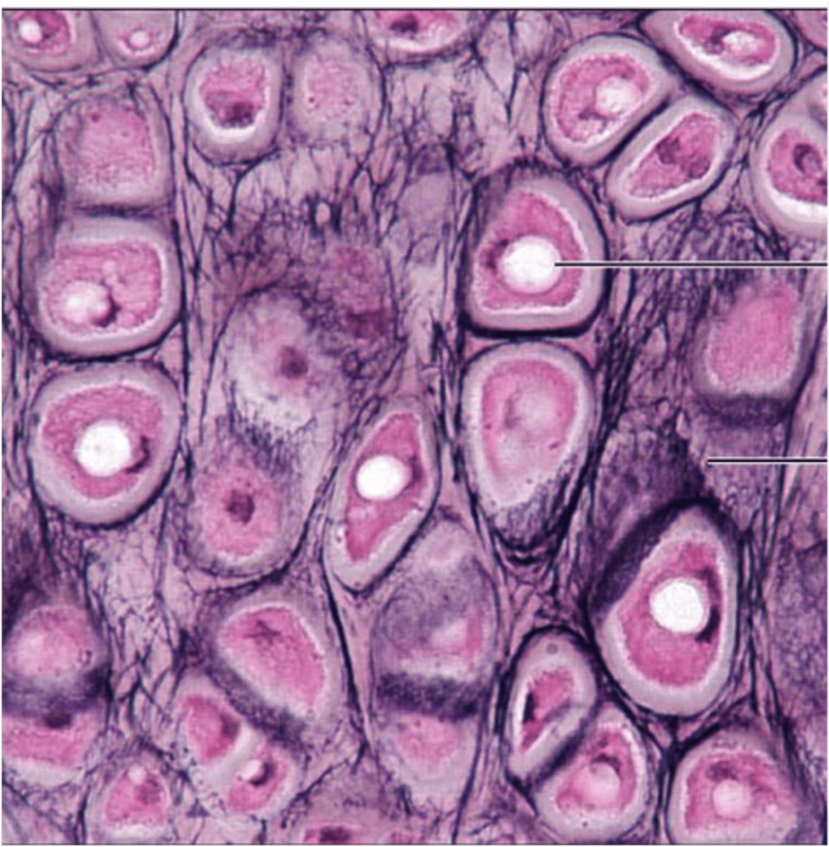 <p>- similar to hyaline cartilage, but more elastic fibers are visible</p><p>- maintains the shape of a structure while allowing great flexibility</p><p>- supports the external ear (pinna) and epiglottis</p>