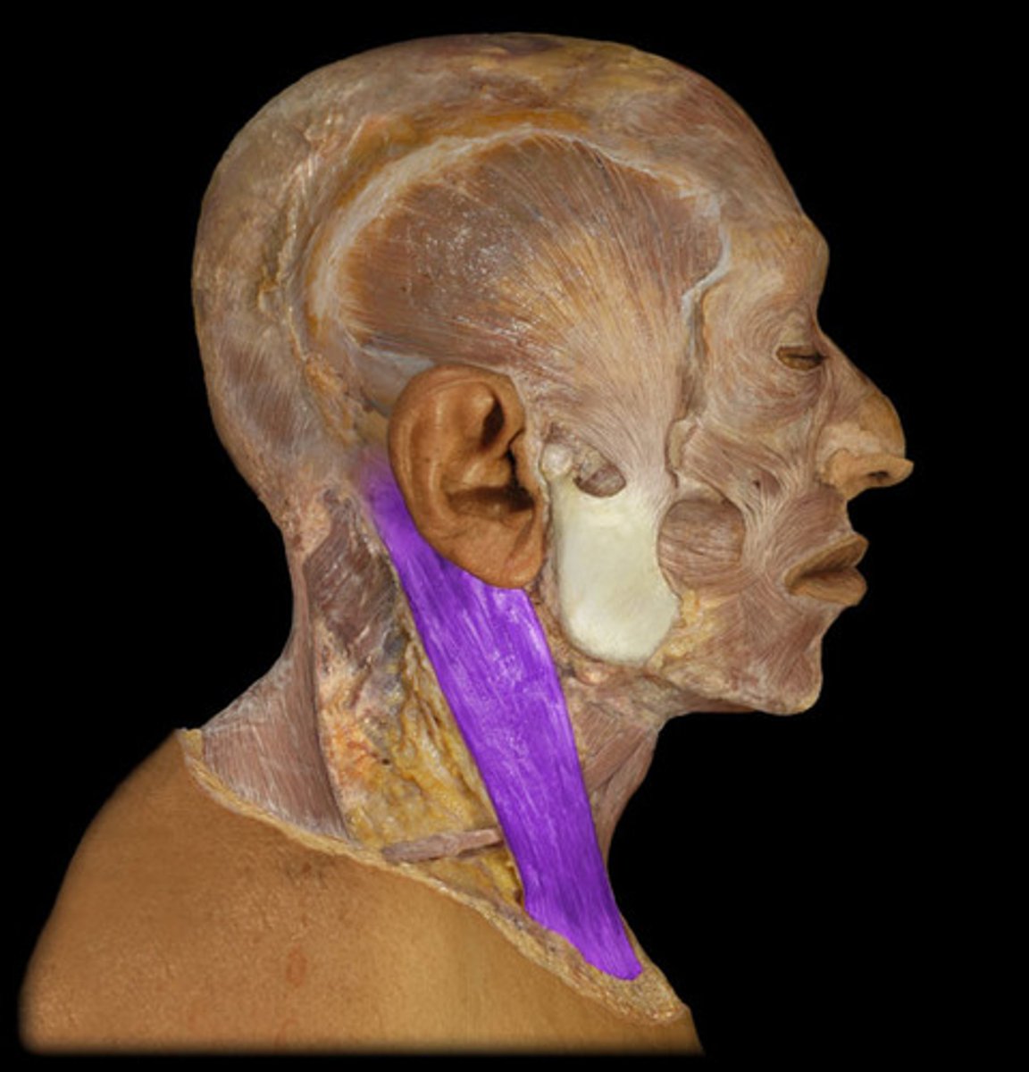 <p><em>identify the structure</em></p>