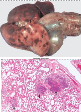 <p>What is this and its causes (what it occurs secondary to-3)</p>