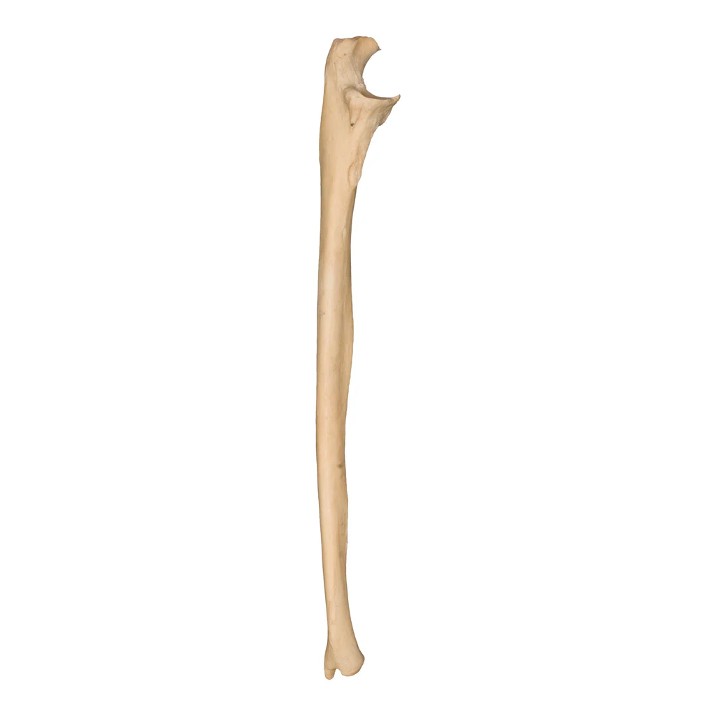 <p>what bone is this</p>