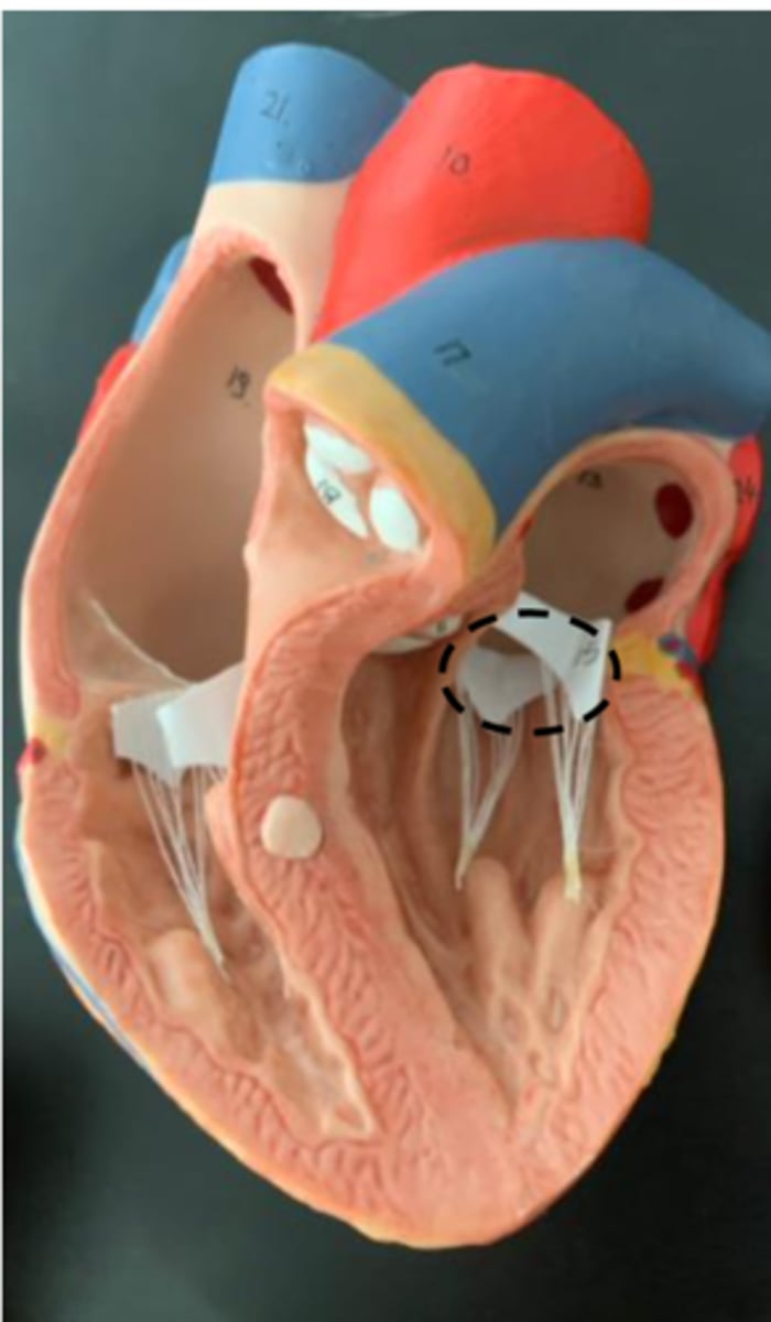 <p>AKA: mitral valve or left atrioventricular valve</p>