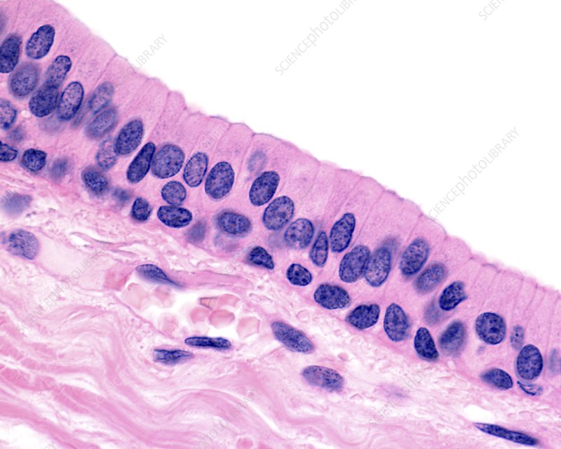 <p>Name this tissue (hint: no cilia, multiple layers)</p>