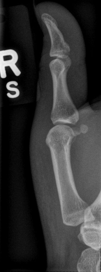 <p>What position is demonstrated?</p>