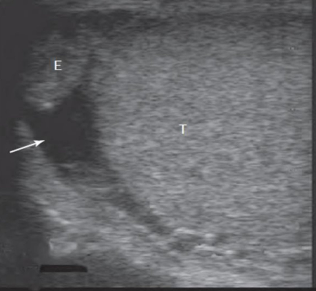 <p>What is the white arrow pointing to?</p>