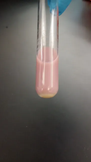 <ul><li><p><strong>*A = Pink </strong></p></li><li><p><strong>pH: </strong>Acid</p></li><li><p><strong>Color: </strong> Pink Milk</p></li></ul><p></p>