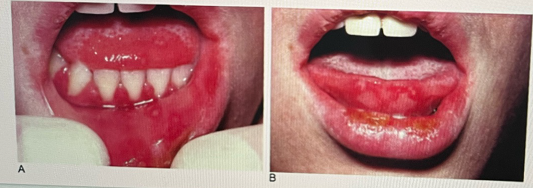 <p>Determine the disease</p>