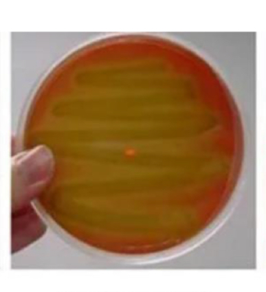 <p>What hemolysis is this?</p>