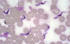 <p><span>Trypanosomiasis</span></p>