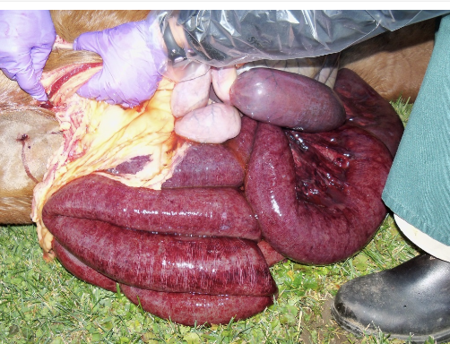 <p>may palpate distended, taught SI loops</p><p>absence of SI does not rule out</p>