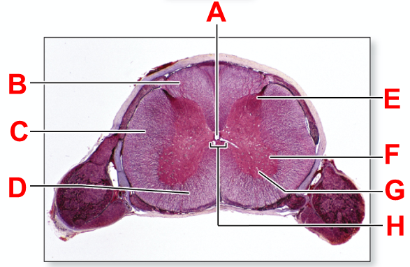 <p>using the spinal cord histology slide, determine label E</p><p></p><p>wordbank: central canal, dorsal funiculus, dorsal horn, gray commissure, lateral funiculus, lateral horn, ventral funiculus, ventral horn</p>