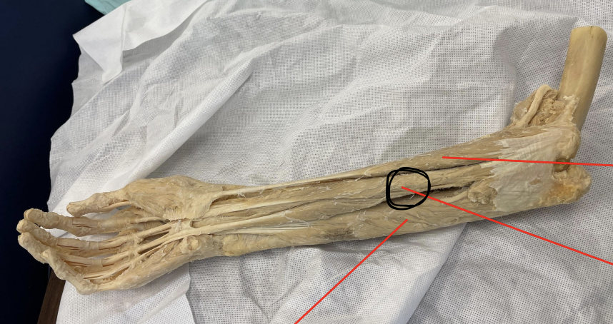 <p>identify + state origin, insertion, action, innervation of marked structure</p>