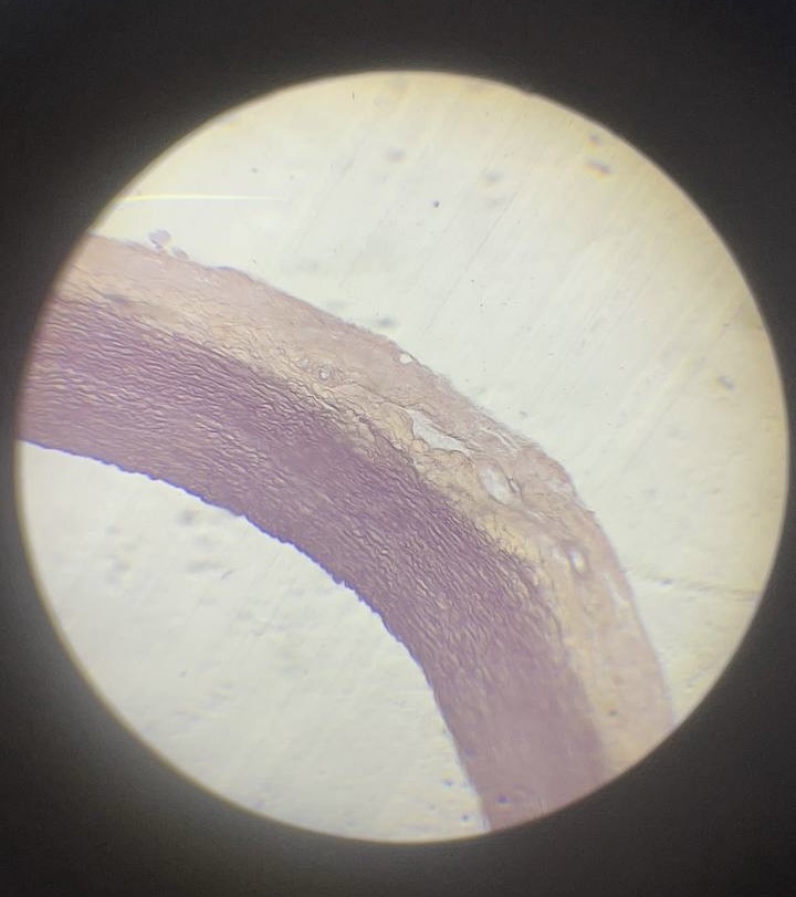 <p>Артерія еластичного типу </p>