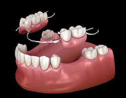 <p>false teeth</p>