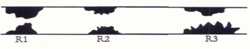 <p>resistances arranged in _______________:</p><ul><li><p>obstructions in the <strong>same vessel</strong>, one upstream and the other downstream</p></li><li><p>resistances add—they combine to form a <strong>higher resistance </strong>than either individual lesion</p></li></ul>