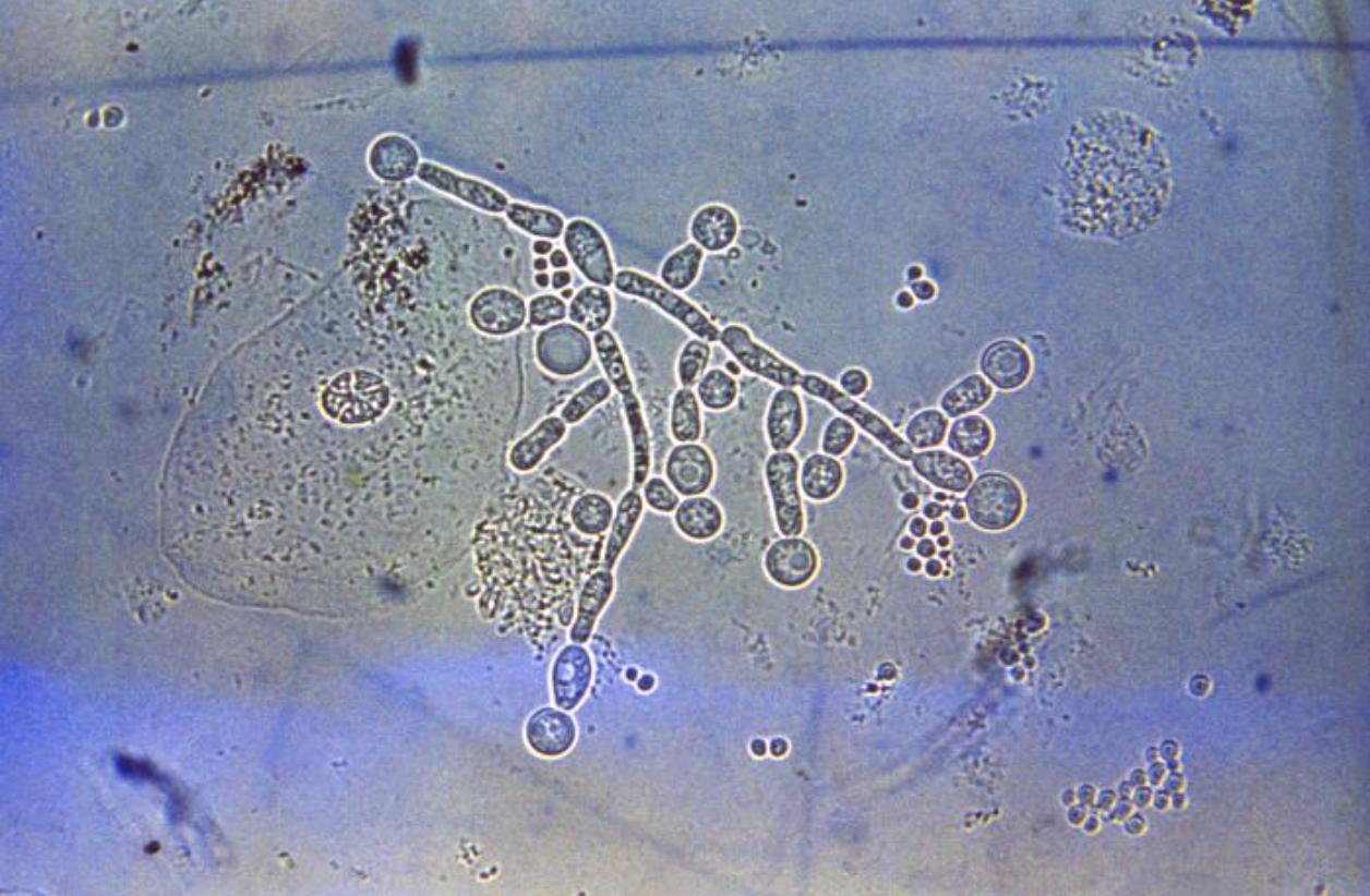 <ol><li><p>Attachment to GI epithelial cells</p></li><li><p>Immune tolerance</p></li></ol><p></p>