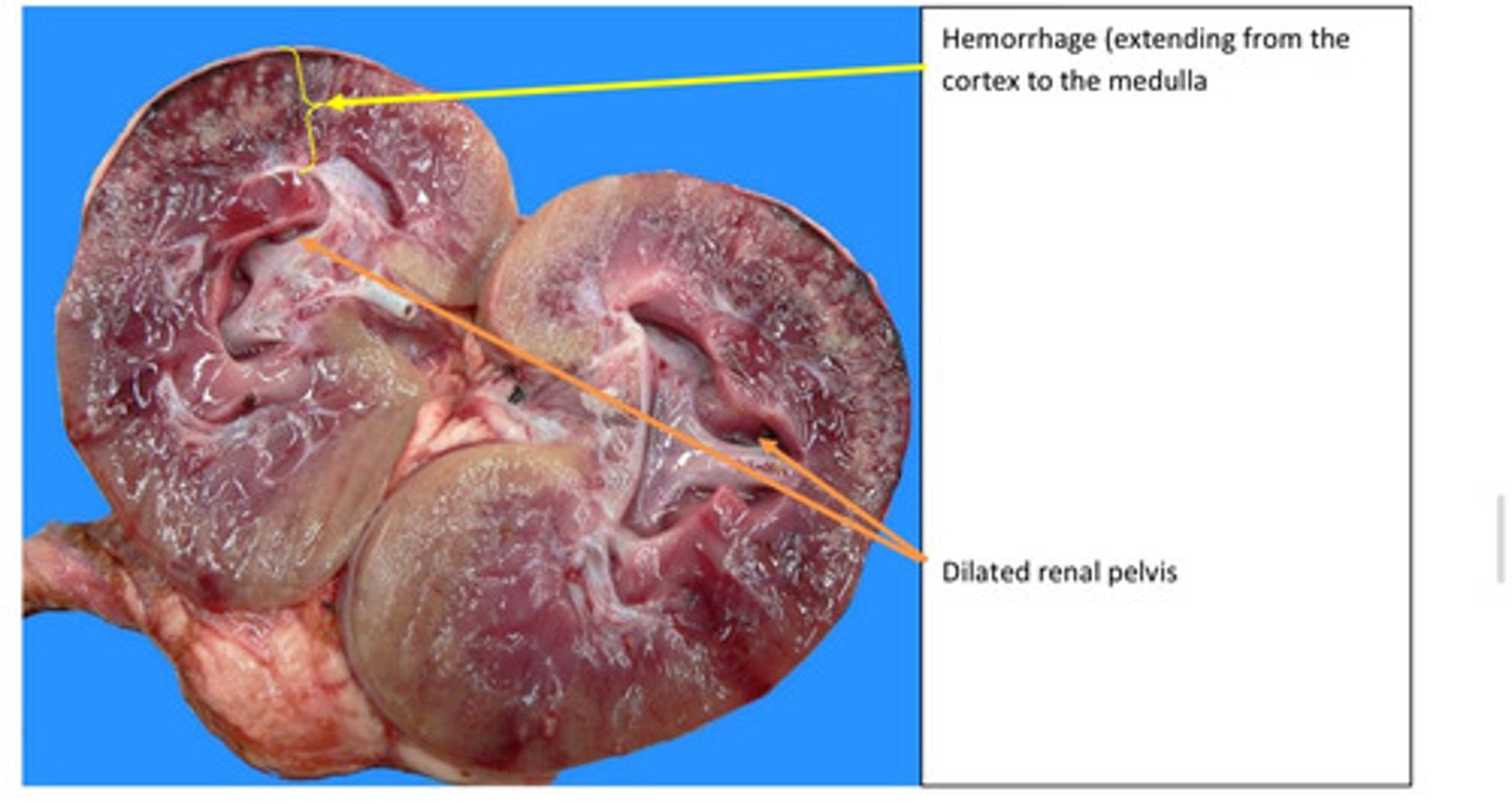 <p>Propose a pathogenesis for observed change in the kidney</p>
