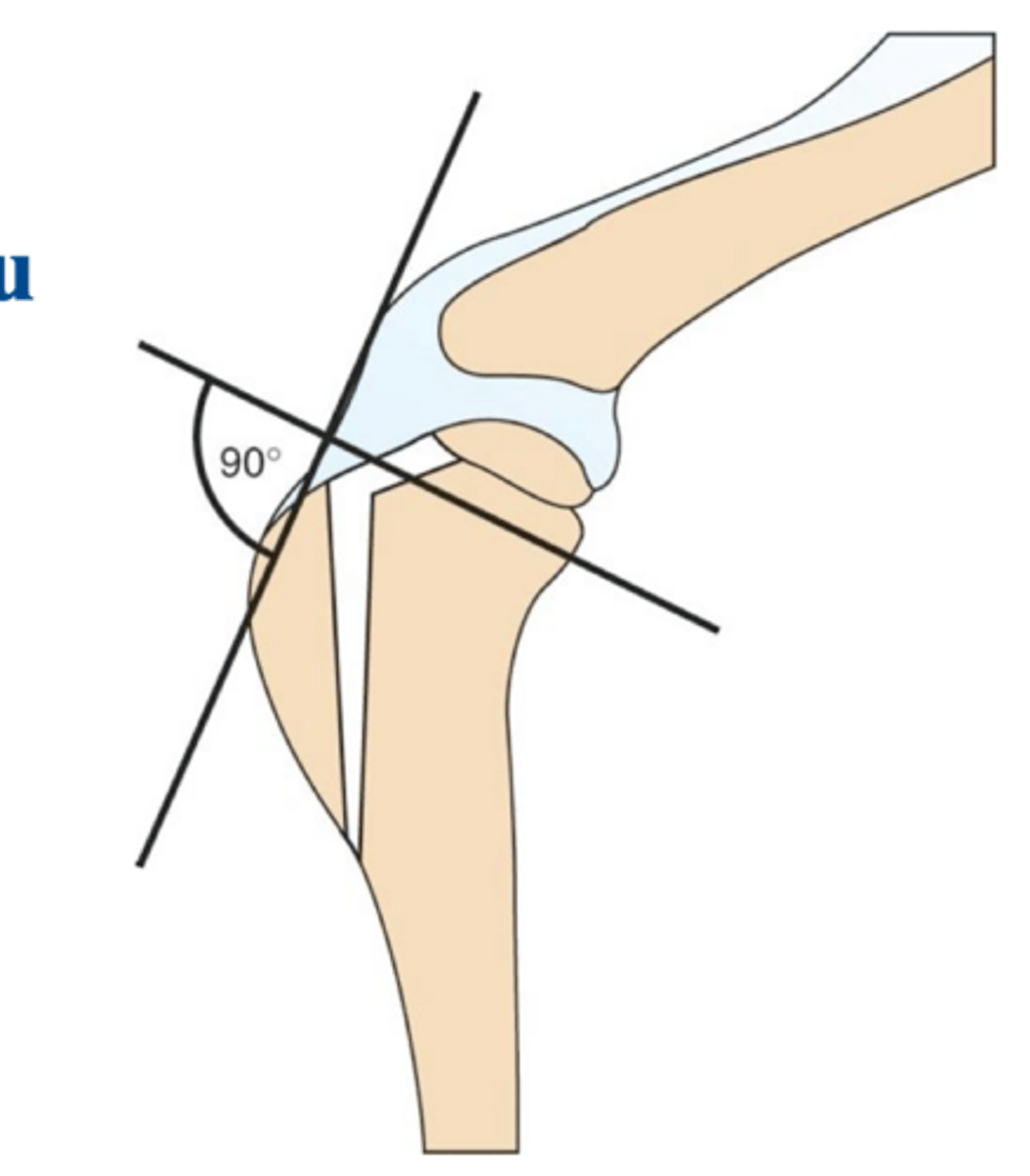 <p>general idea of the tibial tuberosity advancement (TTA) procedure **same general idea for TPLO**</p>