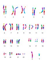 <p>Write down the condition this person has (if they do), and their karyotype notation:</p>