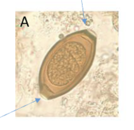 <p>What parasite does this egg belong to?</p>