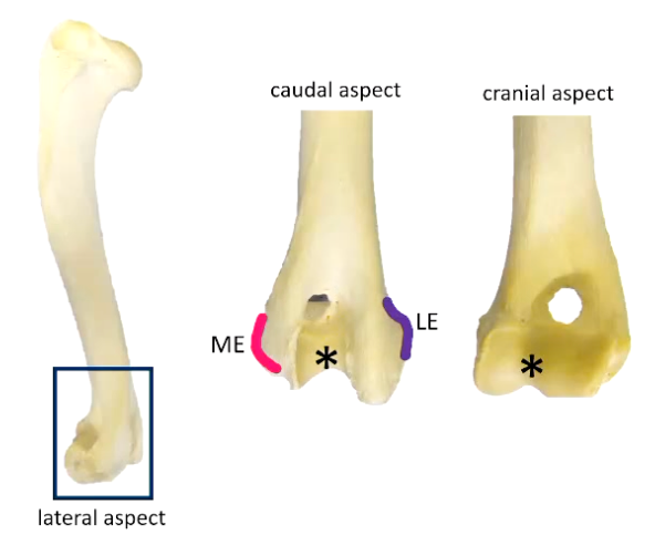 <p>• Distal end called the condyle</p><p>•<strong> Medial epicondyle (ME) - </strong>palpable</p><p><strong>• Lateral epicondyle (LE)-</strong> palpable</p><p><strong>• Trochlea *</strong></p><ul><li><p>Is a central depression</p></li><li><p>Is a smooth articular surface for elbow joint</p></li></ul><p><strong>• Ulnar / olecranon fossa</strong></p><ul><li><p>Caudal aspect</p></li></ul><p><strong>• Radial fossa</strong></p><ul><li><p>Cranial aspect</p></li></ul><p><strong>• Supratrochlear foramen:</strong></p><ul><li><p>Nothing passes through, it is a mechanical foramen, in some dogs it provides a hook or stability to elbow joint</p></li><li><p>May not be present in short legged (chondrodystrophic) dogs</p></li><li><p><mark data-color="#db9d9d" style="background-color: rgb(219, 157, 157); color: inherit;">Absent in larger species eg. horse</mark></p></li></ul><p></p>