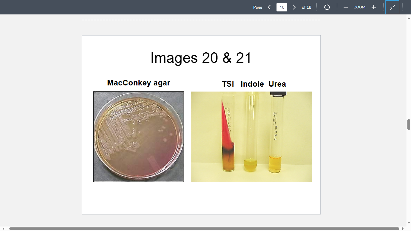 <p>A 47-year-old diabetic male has developed osteomyelitis of the fibula. Culture of a needle aspirate obtained from the infected bone yields these colonies on a MacConkey agar plate (Image 20). The isolate is subcultured on TSI, tryptone and urea containing media (Image 21). What is the most likely cause?</p>