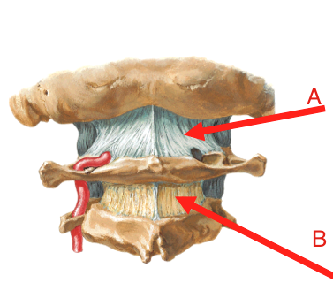 (B) a complex joint made up of three synovial joints, allowing mobile articulation of the spine
