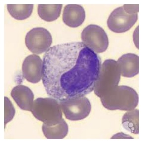 <p><span style="font-family: Helvetica; font-size: 12px;">The neutrophil stage shown in this picture is the most common myeloid cell found in normal adult bone marrow:</span></p>