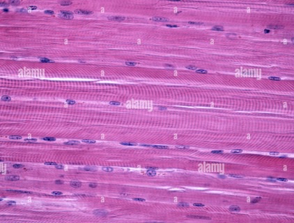 <p>-<strong>cells</strong> are called <strong>fibers or myocytes</strong></p><p>-has <strong>striations</strong> (stripe-looking)</p><p>-<strong>voluntary</strong> (<strong>conscious control over muscle) </strong></p><p><mark data-color="#fdf9d8" style="background-color: rgb(253, 249, 216); color: inherit;"><span data-name="star" data-type="emoji">⭐</span></mark><strong><mark data-color="#fdf9d8" style="background-color: rgb(253, 249, 216); color: inherit;">️elongated nuclei </mark></strong></p>