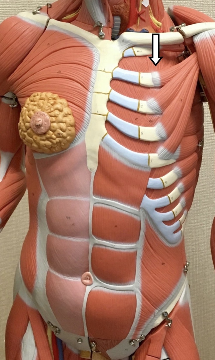 <p><span>Name the muscle labeled with the white arrow below:</span></p>