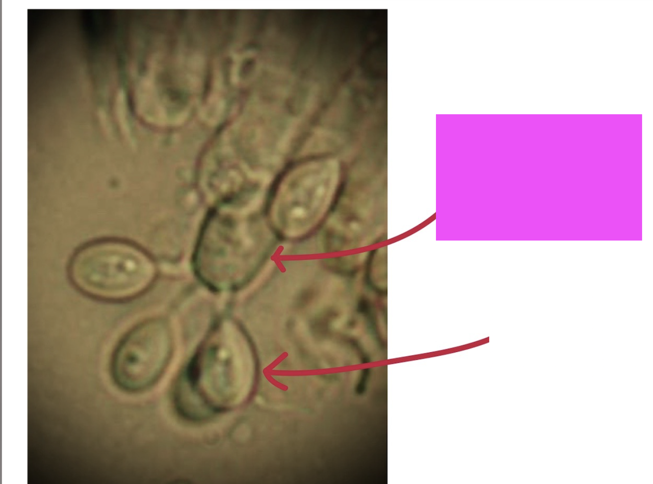 <p>What is the pink arrow pointing to?</p>