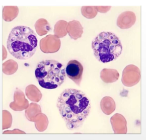 <p>what does&nbsp;<span style="color: rgb(255, 255, 255);"><span>Histoplasma capsulatum infect&nbsp;</span></span></p>