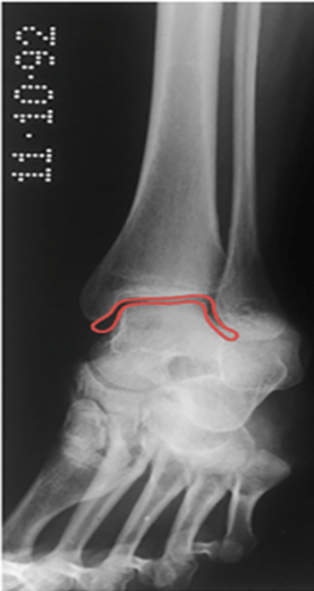 <p>What structure is highlighted?</p>