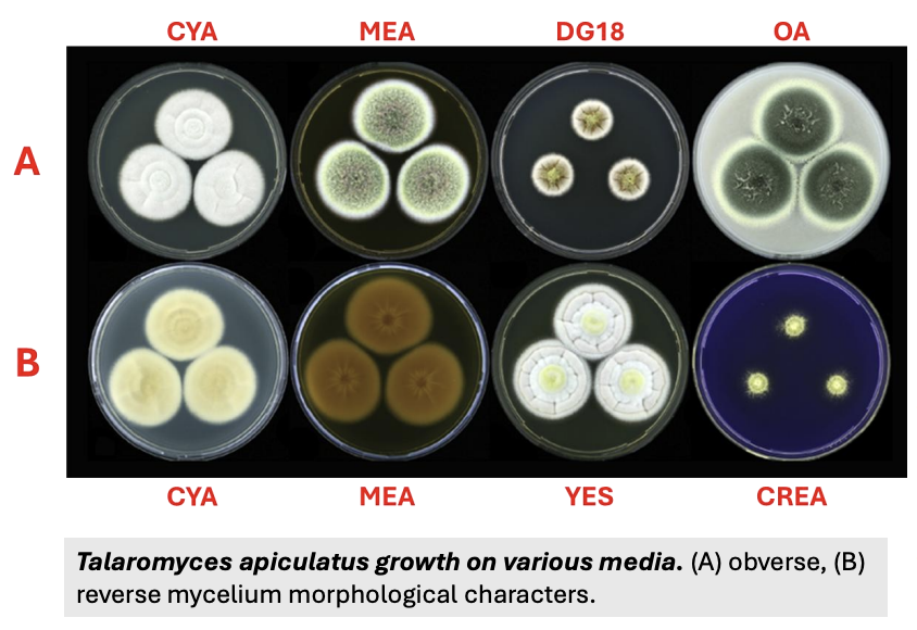 <p>Explain the <strong>3 different types of media and temperatures used for fungal identification (morphological assessment)</strong></p>